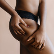© rawpixel.com - African American woman with cellulites