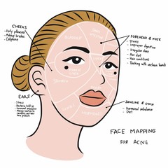 Face mapping for acne , beautiful woman face vector illustration