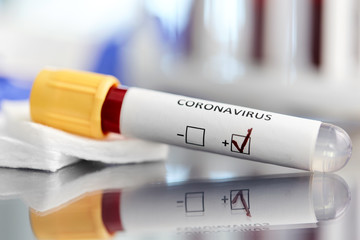 medicine, healthcare and pandemic concept - close up of beaker with positive coronavirus blood test on table at laboratory