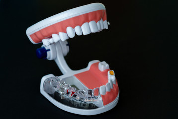 Transparent silicone model of the human jaw with a pin, a practical plastic manual for nurses, doctors and students in dentistry.
