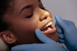 © LIGHTFIELD STUDIOS - orthodontist in latex gloves near happy african american woman in braces