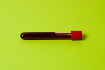 test tube with blood isolate on a green background