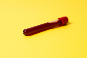 test tube with blood isolate on a yellow background