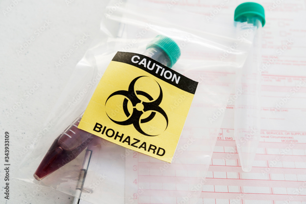 Blood sample with†biohazard†sign Stock Photo | Adobe Stock