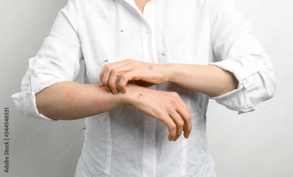 A person itches after mosquito bites. - obrazy, fototapety, plakaty 