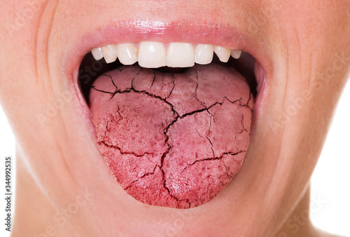 Fotomural Woman Showing Tongue Over White Background