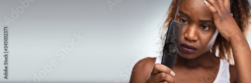 Fotografía Shocked Woman Suffering From Hair Loss Problem
