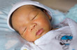 © Bonn - yellow skin colored neonatal jaundice happen in new born baby infant