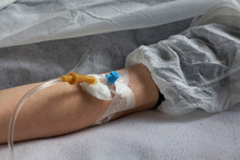 A Peripheral Venous Catheter Is Inserted Into A Vein On The Arm.