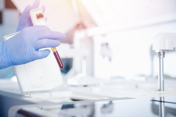 Nurse microbiologist holding test tube with blood for coronavirus 2019-nCoV analyzing