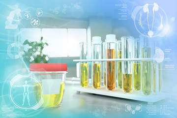 test tubes in modern science study facility - urine quality test for specific gravity or blood in urine hematuria, medical 3D illustration