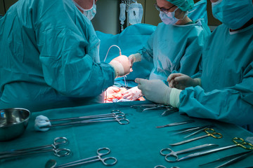 a surgical team performs a surgical abdominal operation