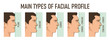 © nmfotograf - Main types of facial profile - convex, concave, plane.