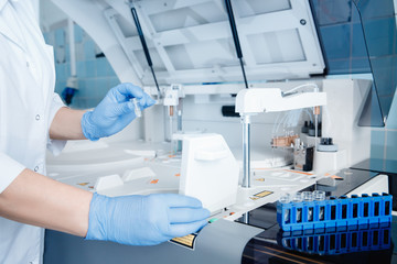 Wall Mural - laboratory technician sets test sample in automatic express tester