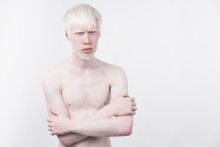 Portrait Of An Albino Man In  Studio Dressed T-shirt Isolated On A White Background. Abnormal Deviations. Unusual Appearance