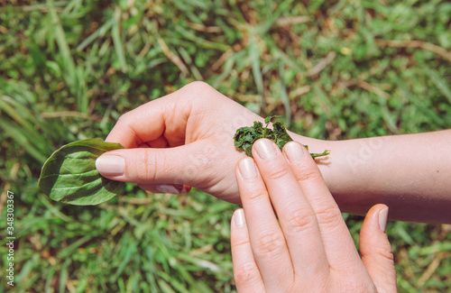 Cuadros en Lienzo Person hand holding and healing wound with antibacterial plant mixture of Plantago major, broadleaf plantain, white man's foot, or greater plantain