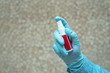 red antiseptic in hand wearing a glove. place for text.