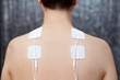 TENS therapy in fibromyalgia and cervicalgia treatment - electrodes placed on female patient's shoulders.