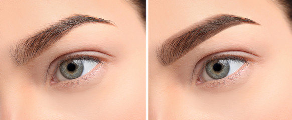 Poster - Woman before and after eyebrow correction, closeup. Banner design