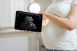© rh2010 - Pregnant woman holding digital tablet with an ultrasound scan of her unborn baby, standing in medical office, close-up view