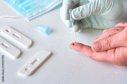 Fotomural Rapid COVID-19 test for detection of specific antibodies IgM and IgG to novel corona virus SARS-CoV-2 causing Covid-19 illness