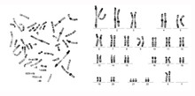 Digitally Generated Image Of Karyotype Over White Background