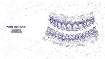 Wall Mural - Dental jaw with braces on teeth close-up. Correct bite correction of teeth. Orthodontics, stomotology, innovative medical technology. 3d low poly wireframe vector illustration.