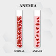 world hemophilia day red blood cell Iron deficiency anemia difference of Anemia amount of and normal symptoms vector illustration medical.
