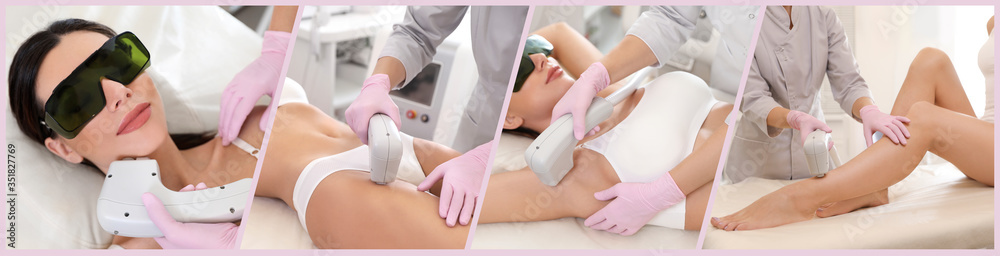 Collage with photos of woman undergoing laser epilation procedure. Banner design - obrazy, fototapety, plakaty 