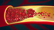 Embolism caused by a blood clot in a constricted blood vessel - 3d illustration
