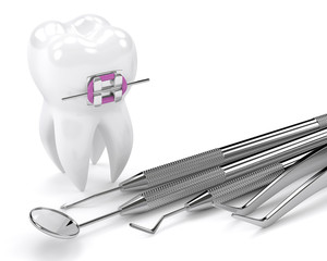 Wall Mural - 3d render of tooth with braces and dental diagnostic instruments