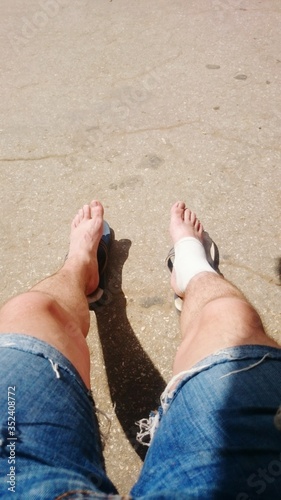 Elevated View Of Man\'s Legs With Bandage