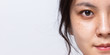 Close up half fresh face of Asian women is looking at camera on white banner background with copy space, Problem skin face, Freckle on face of Asian women, 