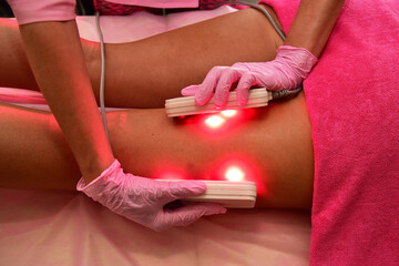 lipo laser. Hardware cosmetology. Body care. Non surgical body sculpting. body contouring treatment, anti-cellulite and anti-fat therapy in beauty salon.