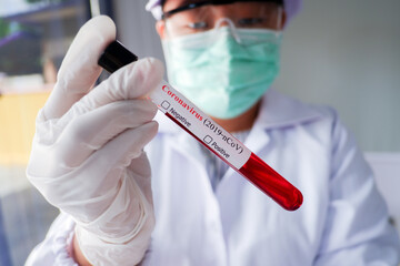 The cropped shot view of the Scientist researching, developing and testing the virus vaccine with human's blood sample.