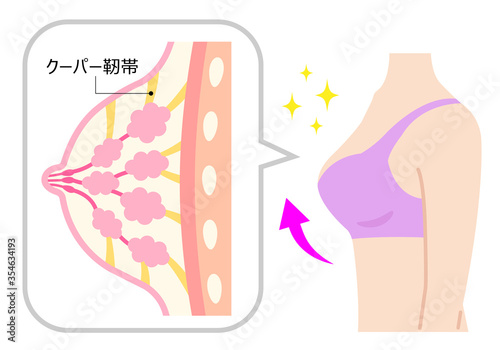 バストアップ 女性 断面図 豊胸 きれい 仕組み 図解 図 組織 断面 美しい 明るい 構造 人体 ボディパーツ 若い 白バック ブラ ナイトブラ 美容 胸 おっぱい 乳房 上半身 丸み クーパー靭帯 エイジング イラスト ベクター 明るい きれい シンプル アンチエイジング
