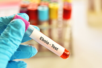 Wall Mural - Test tube with blood sample for ebola virus test