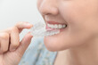 © Varangkana - Woman wearing orthodontic silicone trainer. Mobile orthodontic appliance for dental correction. tooth whitening systems.