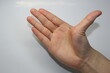 Demonstration of hypermobility of a thumb in open palm position.