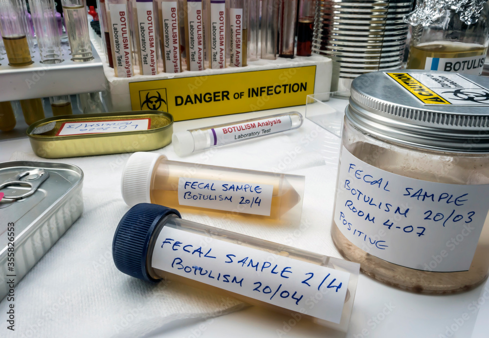 Samples contaminated by Clostridium botulinum toxin that causes ...