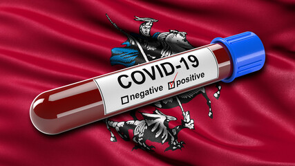 Wall Mural - Flag of Moscow waving in the wind with a positive Covid-19 blood test tube. 3D illustration concept for blood testing for diagnosis of the new Corona virus.