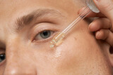 Fototapeta  - Men's skin care. Close-up facial procedure for a model. Vitamins for the restoration and renewal of the face.