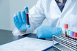 © Orathai - Professional doctors perform find virus tests from samples of blood tests to diagnose coronary virus infections analysis and sampling of infectious