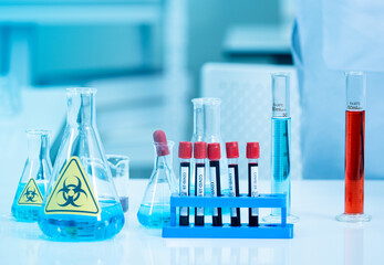 Equipment in the Laboratory. Selective focus Covid-19 blood sample in test tube.