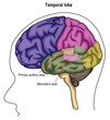 The temporal lobe of brain.