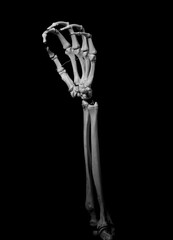 human forearm skeleton anatomy bone