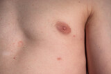 34 Third Nipple Images, Stock Photos, 3D objects, & Vectors