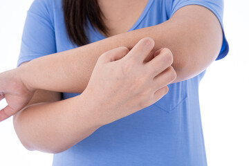 Female scratching her arm on isolated white background. Medical, healthcare for advertising concept.