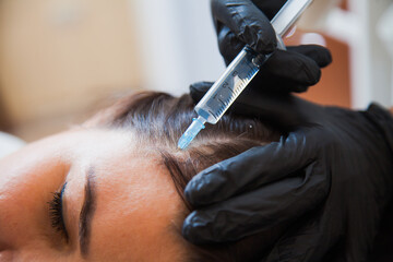 Unrecognizeble female person at trichologist office get injections in head skin. Doctor's hands holding disposable syringe under patient's head. Porcedure against hair loss and for skin health.