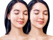 © Galaxy_love_design - Young woman before and after chin correction.